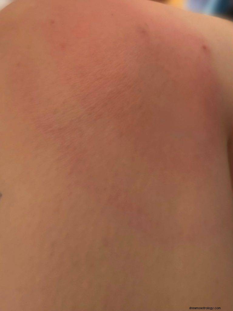 The Health Toll of a Saturn Square Sun: A First‑Person Insight