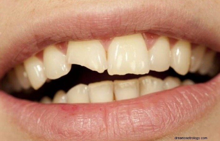 Wyszczerbiony ząb – senne znaczenie i symbolika 