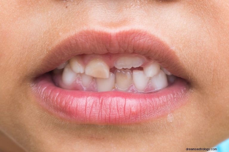 Vad betyder det att drömma om att tänderna faller sönder? 