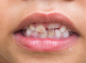 Co to znamená snít o rozpadajících se zubech? 