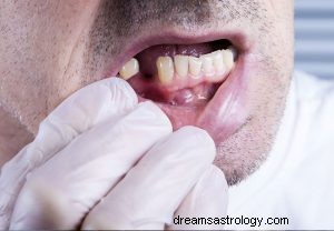 Co to znamená snít o špatných zubech? 