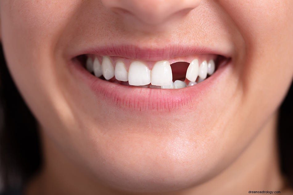 Sen o złamanych zębach – znaczenie i symbolika 