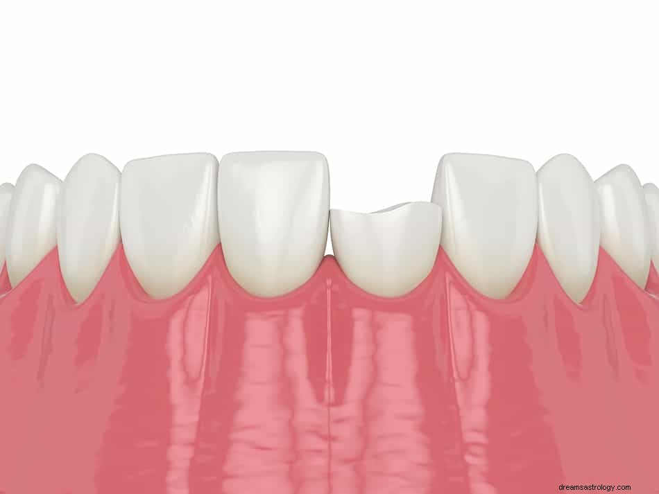 Rêve de dents cassées - Signification et symbolisme 