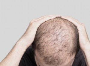 Sogno a testa calva Significato:testa a testa! Niente di cui aver paura 