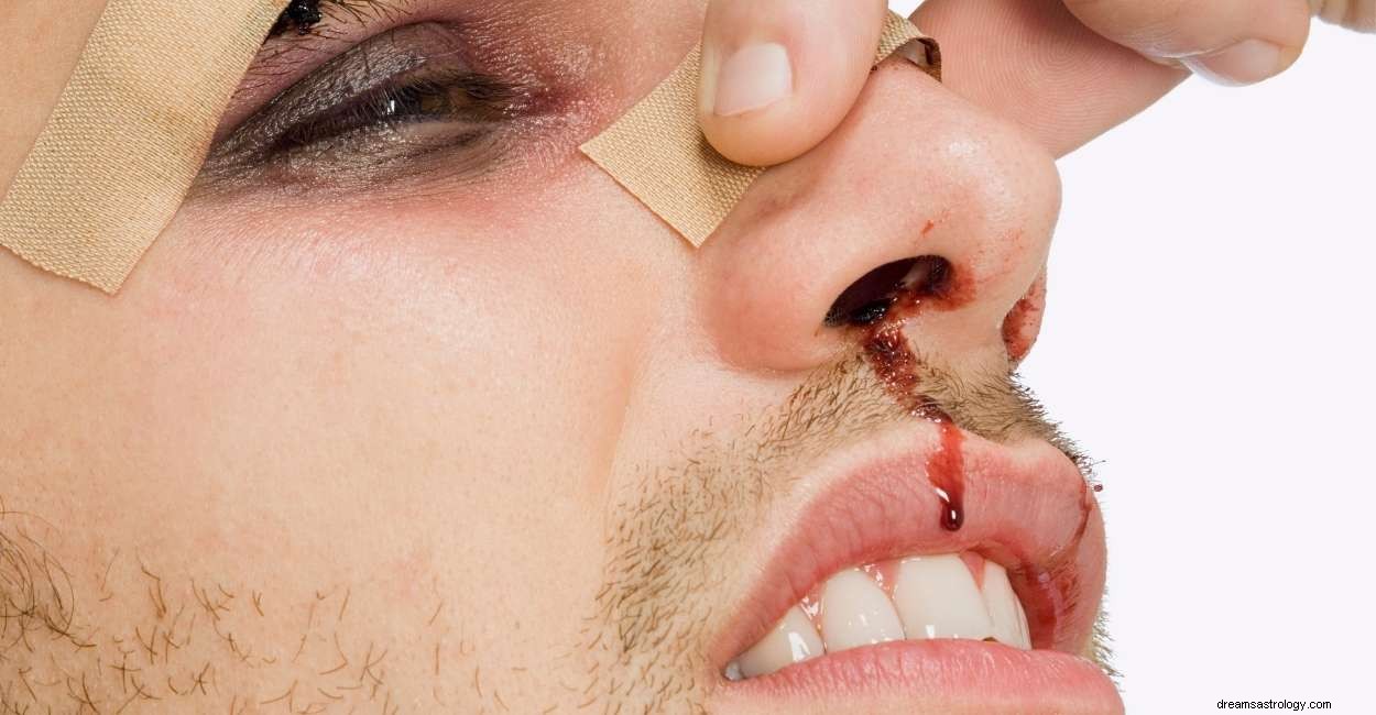 Drømte du om neseblødning i natt? Her er hva det betyr 