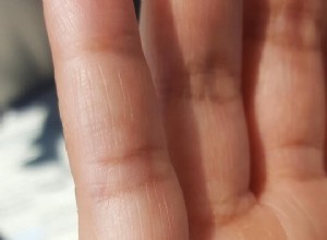 Child Line Handlijnkunde