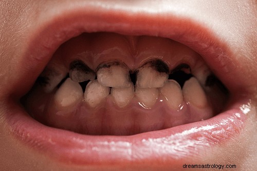 Sognare di perdere i denti:come interpretarlo?