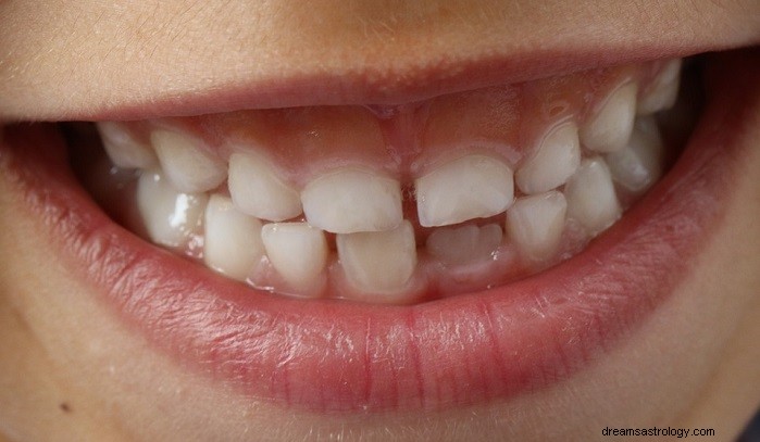 Sny o vypadávání zubů, ztrátě zubů – význam a výklad