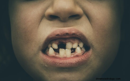 Tanden vallen uit Droombetekenis en interpretatie