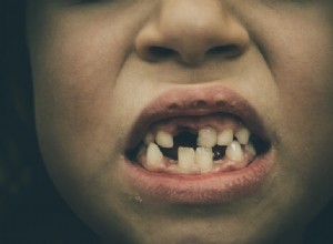 Vypadnutí zubů Význam snu a jeho výklad