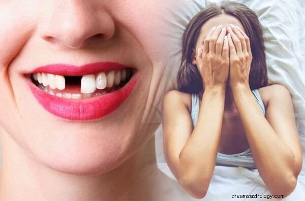 Vypadnutí zubů Význam snu a jeho výklad