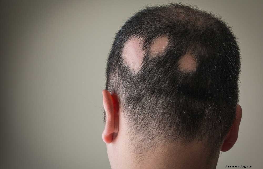 Zal je echt je haar verliezen als je droomt dat haar uitvalt?