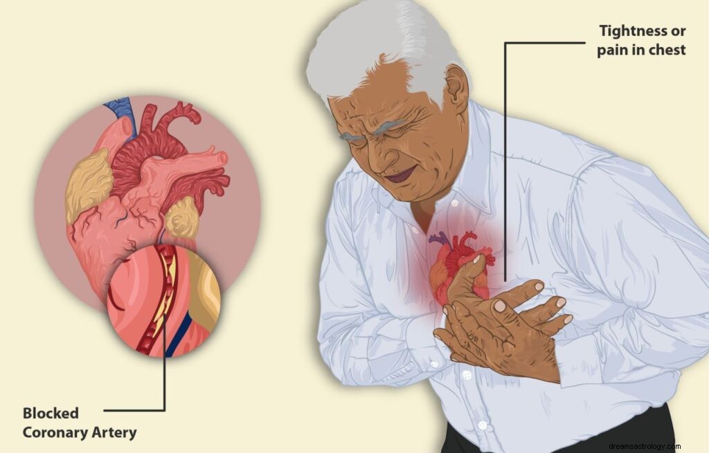 5 tolkningar av en dröm om hjärtinfarkt:Är det ett gott tecken?