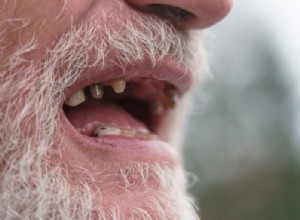 Φθαρμένα δόντια – Όνειρο νόημα και συμβολισμός