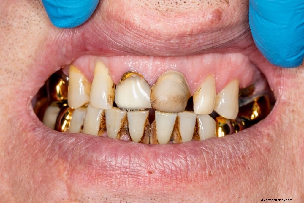 Hårdnet tand – drømmebetydning og symbolik