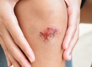 傷 – 夢の意味と象徴