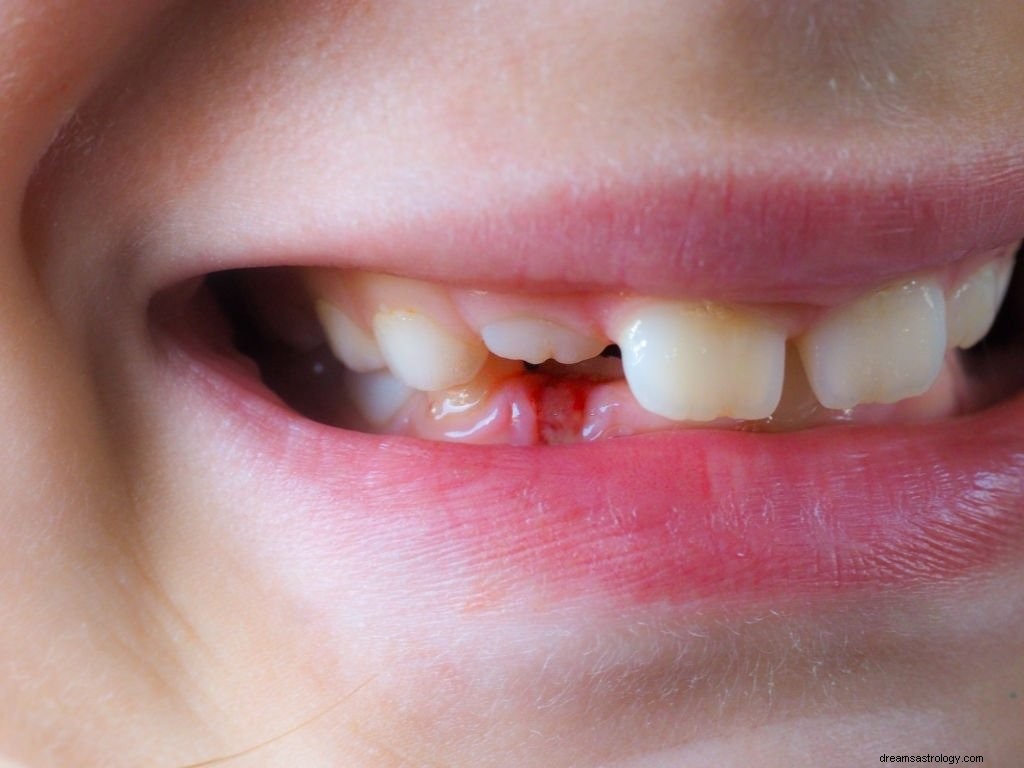 Jatuh Gigi – Arti Mimpi dan Simbolisme
