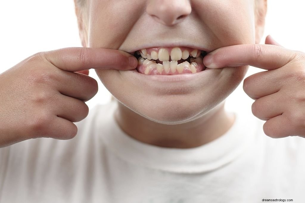 Crooked Teeth – Dream Betekenis en symboliek