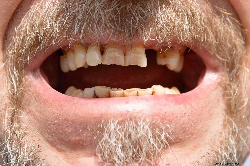 Křivé zuby – význam snů a symbolika