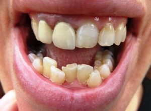 Křivé zuby – význam snů a symbolika