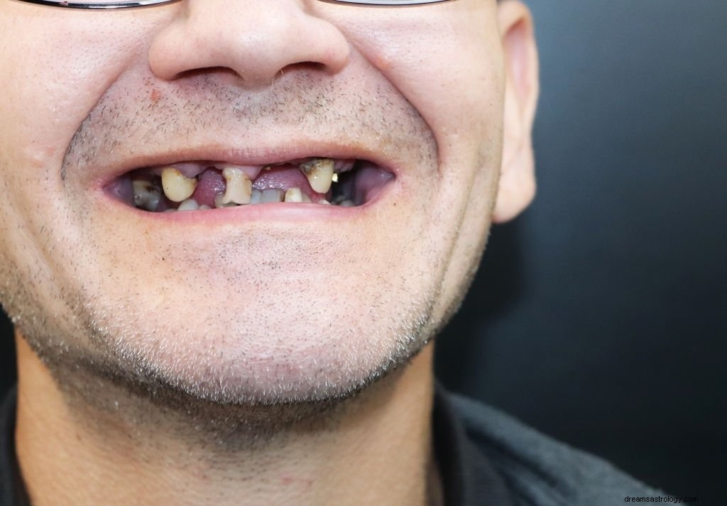 Förfallen tand – drömmening och symbolik