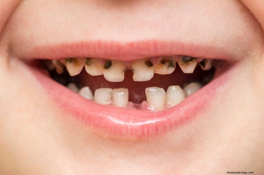 Förfallen tand – drömmening och symbolik