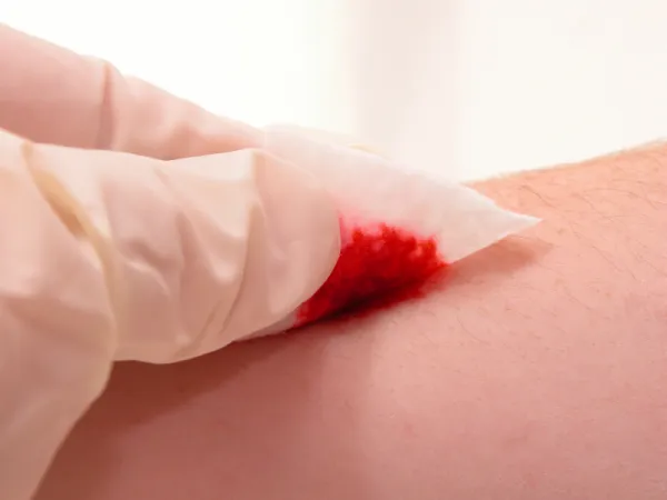 O que significa sonhar com sangue