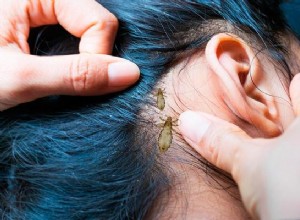 Hvad betyder det, når du drømmer om lus?